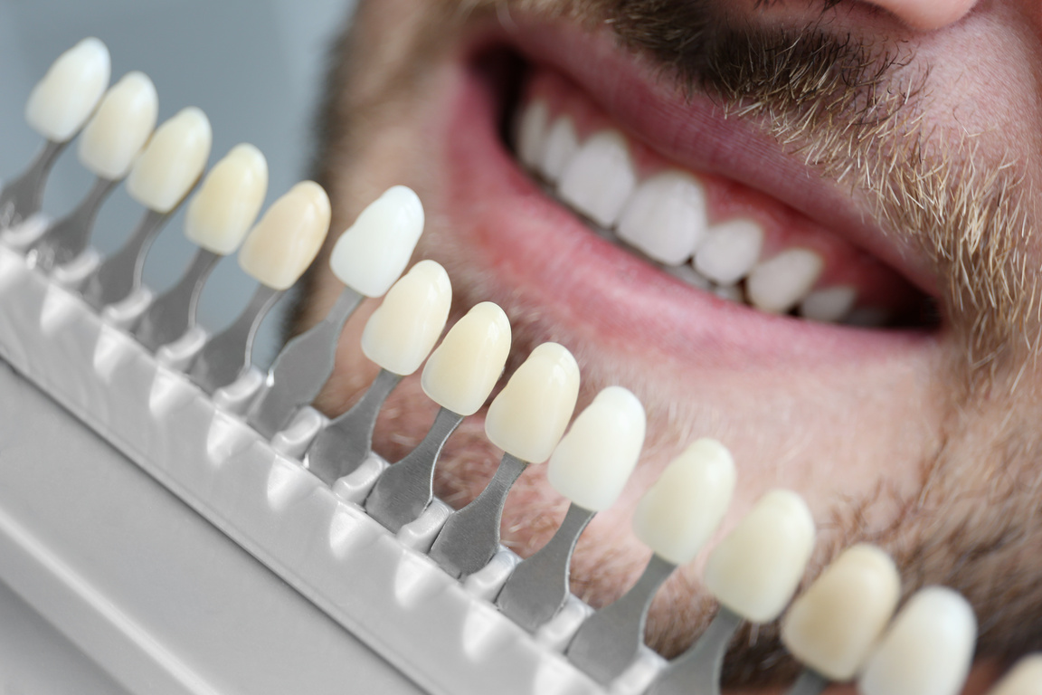 Man and Veneer Color Chart 